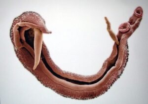 Schistosome blood fluke parasite in human veins